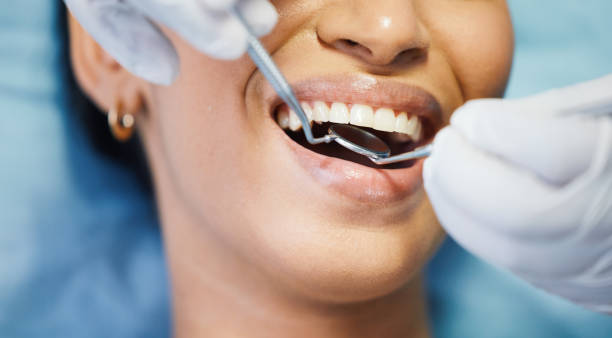 Best Emergency Denture Repair in Johnsonville, SC